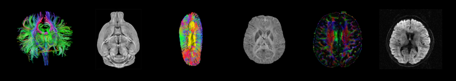 Brain images