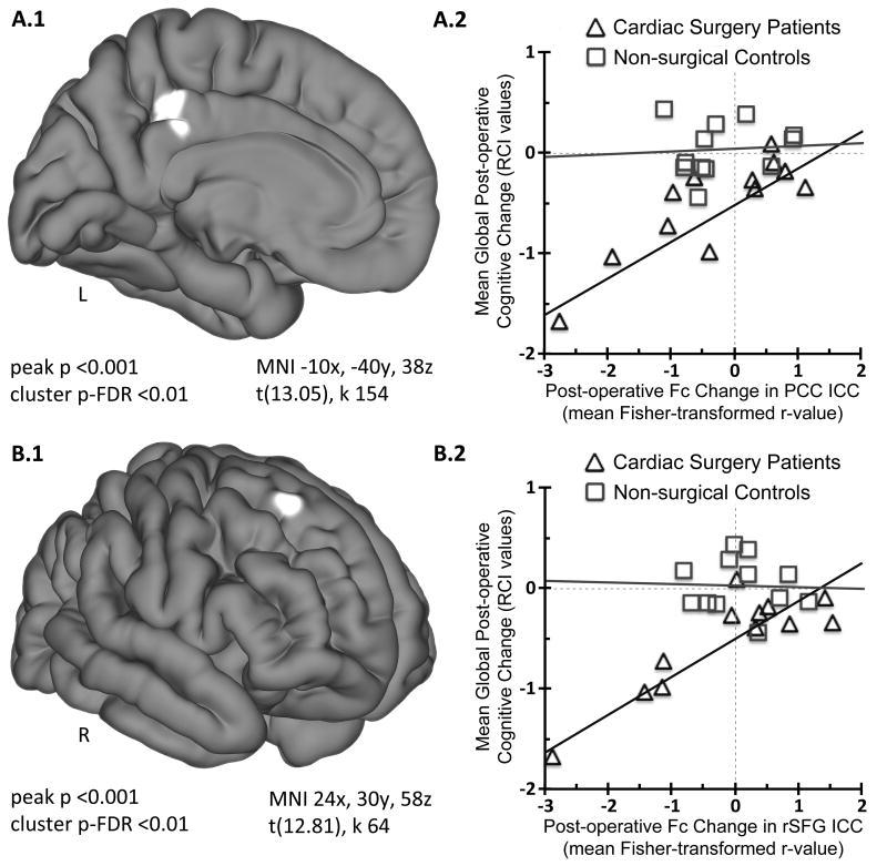 Regional Changes in Intrinsic Functional Connectivity