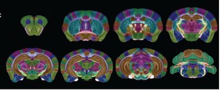 Imaging Biomarkers for Alzheimer’s Disease