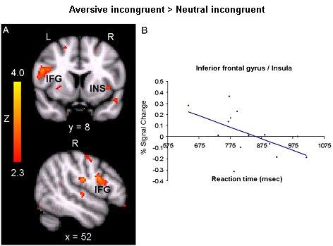 Aversive incongruent > Neutral incongruent