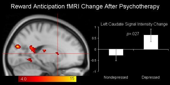 Reward Anticipation fMRI Change after Psychotherapy