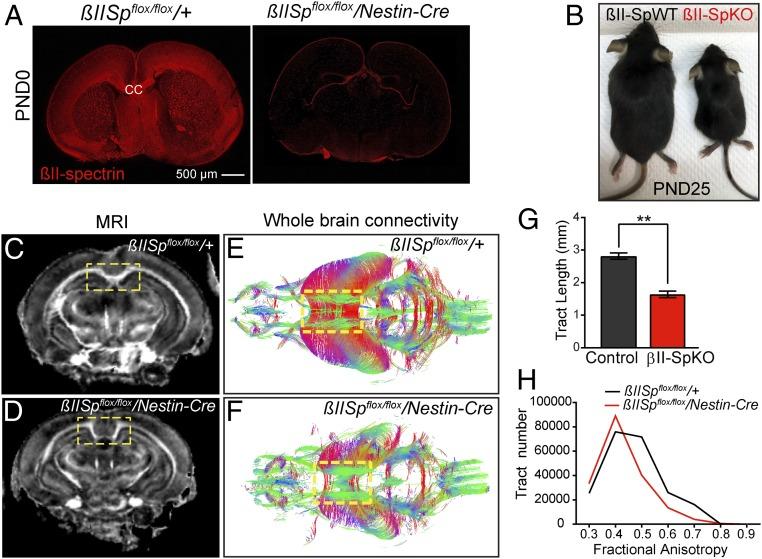 Brain βII-spectrin is required for axonal integrity and long-range axonal connectivity