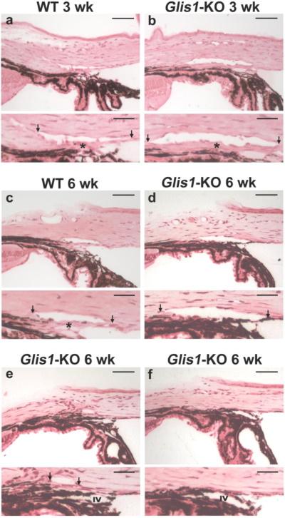 Ocular angle drainage structures in Glis1-KO mice