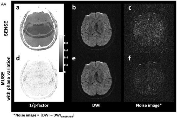 SENSE and MUSE brain images