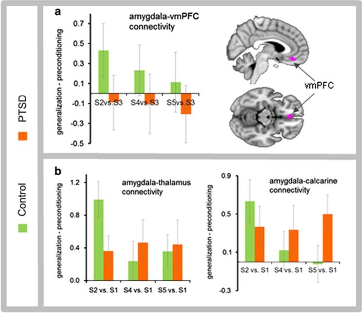 Task-modulated functional connectivity