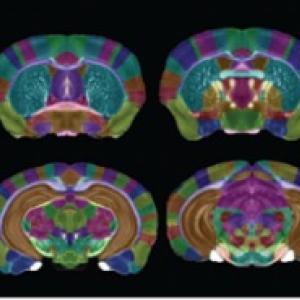 Imaging Biomarkers for Alzheimer’s Disease