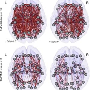 The distribution of connectivity increases over a 2-year period throughout the whole brain for four representative subjects