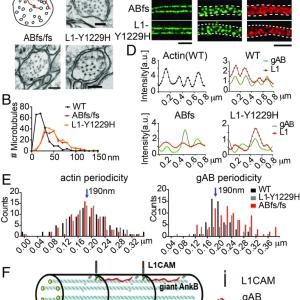 Giant ankB colocalizes with L1CAM