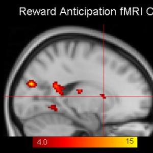 Reward Anticipation fMRI Change after Psychotherapy