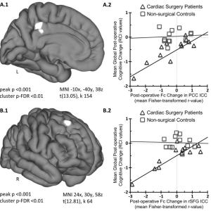 Regional Changes in Intrinsic Functional Connectivity