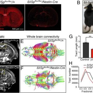 Brain βII-spectrin is required for axonal integrity and long-range axonal connectivity