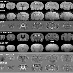 T1-weighted RARE and mGRE mouse brain images