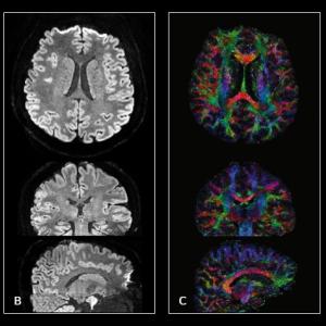 MUSE brain images