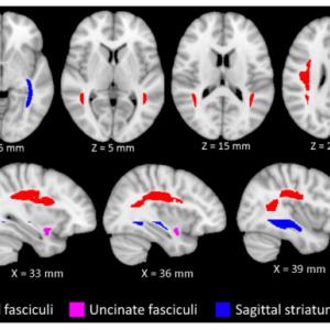 Brain regions related to musical proficiency and age