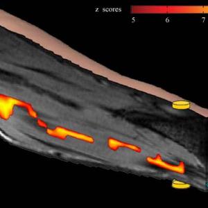 Neuroelectric Activity In Vivo