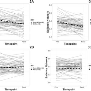 Plot of mean pre and post functional network connectivity values for MCI and non-MCI surgery