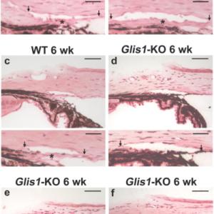 Ocular angle drainage structures in Glis1-KO mice