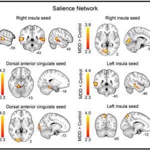 Group differences in resting-state connectivity