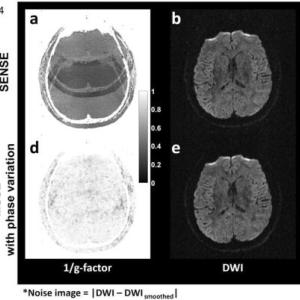 SENSE and MUSE brain images