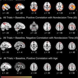 Voxelwise activation for all trials relative to the implicit baseline