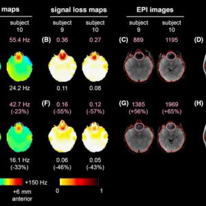 iPRES_fMRI
